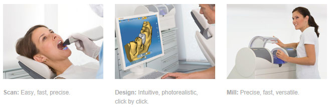 Hornsby-Dental-CEREC-3-steps