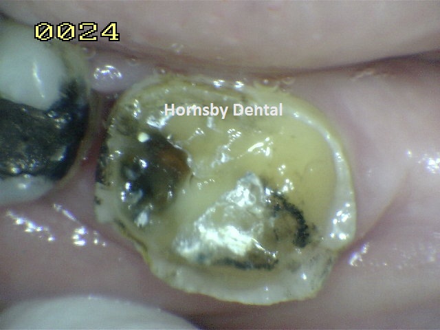 Hornsby-Dental-Case-6-Before